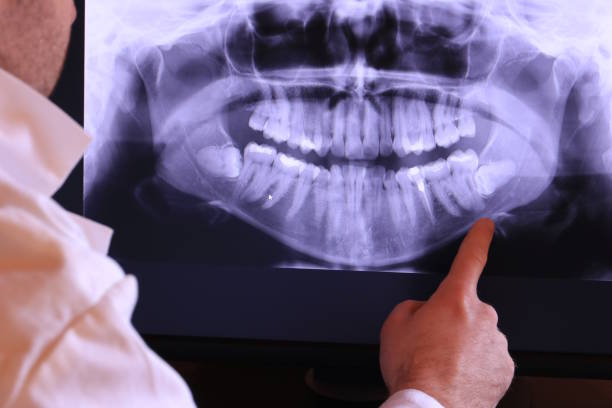 Best Walk-In Emergency Dentist in West, TX