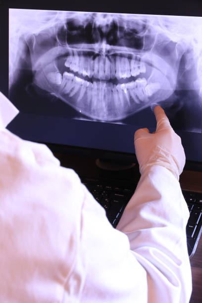 Best Emergency Root Canal Treatment in West, TX